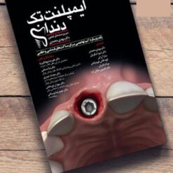ایمپلنت تک دندان (یک رویکرد کم تهاجمی برای ساکت های قدامی و خلفی)